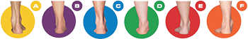 my foot type