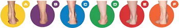 my foot type