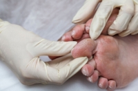 The Importance of a Diabetic Foot Exam